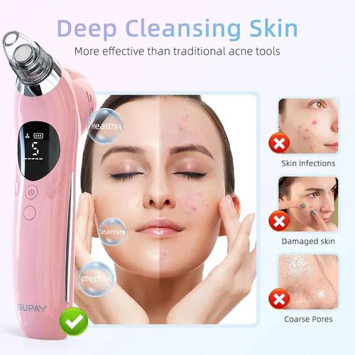 Miniatura 3 de Removedor de puntos negros, aspiradora facial, limpiador de poros eléctricos, comedones, 5 sondas de succión y 5 niveles de succión, herramientas