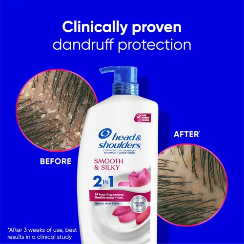 Miniatura 4 de Head & Shoulders Matt Loves Hair Favorites: Smooth & Silky 2 in 1 (28.2oz) + Bare Itchy Scalp Relief Serum (4.2oz) - Dandruff Shampoo and