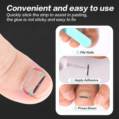 Miniatura 5 de Herramienta de tratamiento de uñas encarnadas de aleación de titanio, kit de eliminación de uñas de los pies para reparación de uñas curvas, 10