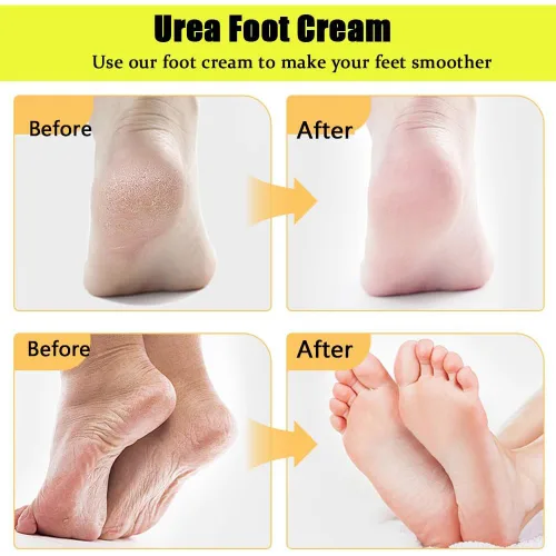 Miniatura 7 de Crema Hidratante y Anti-Grietas para Pies con 60% de Urea, 2026 NUEVA Crema Hidratante y Alivio de Grietas y Sequedad, Stick de Cuidado de Pies que