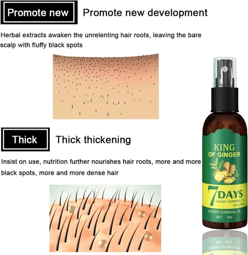 Miniatura 6 de Shouga Kingu Aceite de jengibre para el crecimiento del cabello, aceite germinal de 7 días, control de caída del cabello, tratamiento para cabello