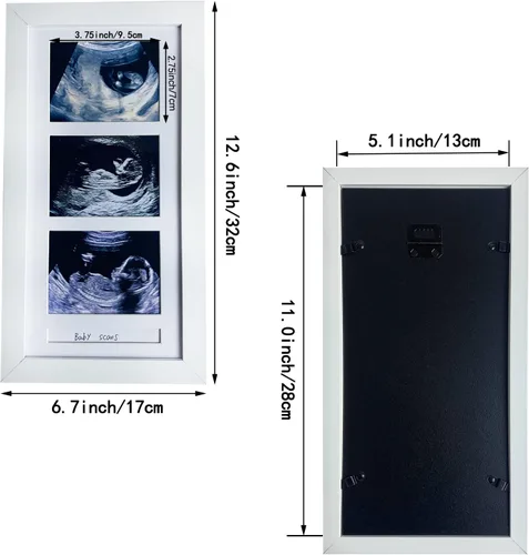 Miniatura 3 de Marcos de fotos de ultrasonido triple, marco de fotos de sonograma, 3 fotos, anuncios de embarazo, regalos de embarazo para madres primerizas, Blanco