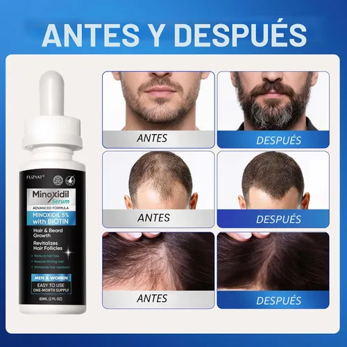 Miniatura 4 de 5% de minoxidil para hombres, minoxidil para mujeres, tratamiento para el crecimiento del cabello, suero de crecimiento de barba, enriquecido