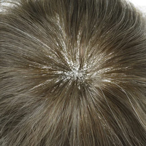 Miniatura 154 de Sistema de repuesto de cabello humano europeo con encaje frontal suizo para hombre, tupé para hombre, pieza de cabello, nudo blanqueado, línea #17