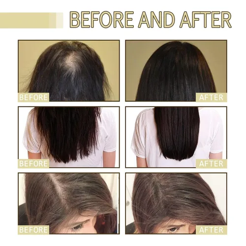 Miniatura 4 de Carvenchi Aceite natural para el crecimiento del cabello con aroma a romero, para cabello seco dañado y fino, incoloro, 2 unidades, 4 onzas incoloro