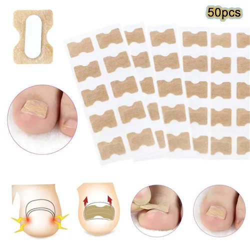 Miniatura 2 de Parche de corrección de uñas encarnadas, 50 calcomanías de uñas encarnadas sin pegamento para uñas encarnadas curvadas para el cuidado de los pies