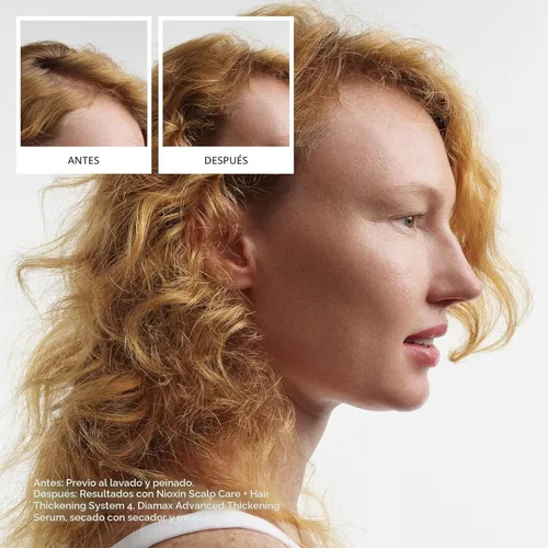 Miniatura 2 de Nioxin System 4 Champú Espesante para Cuero Cabelludo + Cabello para Cabello Teñido, Seco y Dañado con Adelgazamiento Progresivo Mantiene