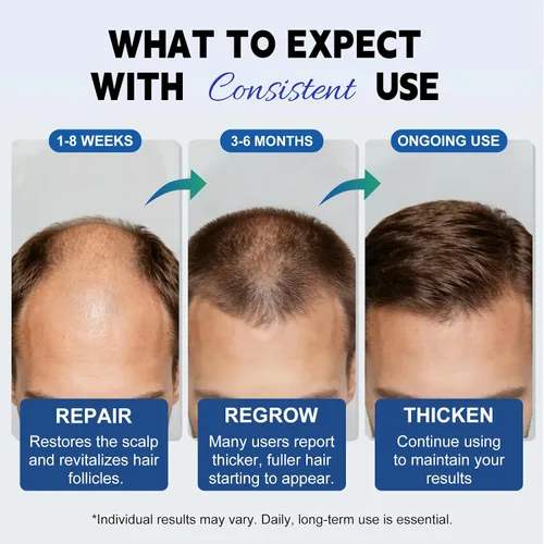 Miniatura 2 de Paquete de 6 soluciones tópicas de minoxidil al 5% para hombres y mujeres, tratamiento de crecimiento del cabello para adelgazamiento del cabello