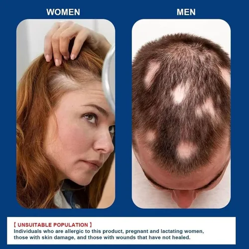 Miniatura 3 de Crema de masaje para el cuero cabelludo de Minoxidil al 5%