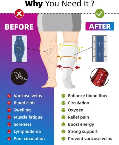 Miniatura 3 de Paquete de 3 calcetines de compresión de talla grande para mujeres y hombres, medias altas hasta la rodilla de 20-30 mmHg para piernas grandes e