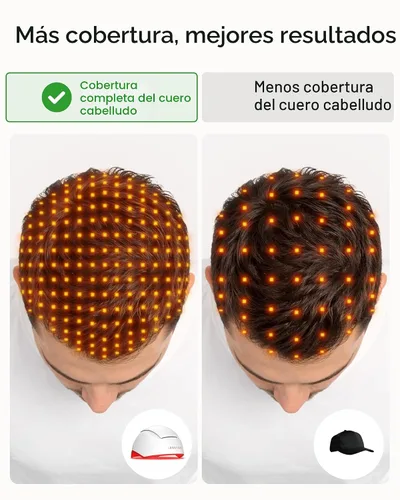Miniatura 3 de iRestore - Sistema para crecimiento del cabello + baterías recargables, gorra láser aprobada por la FDA (Administración de Alimentos y Medicamentos)
