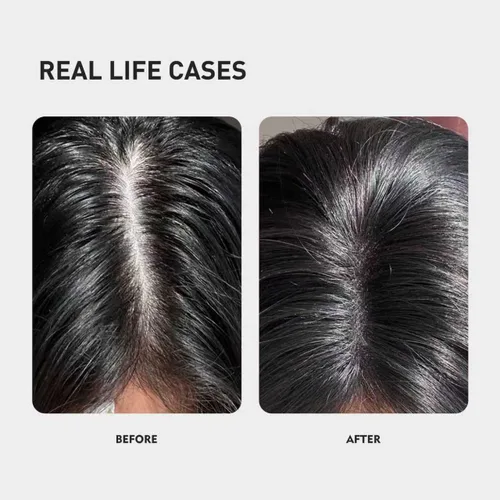 Miniatura 4 de Kintor Sueros de densidad capilar KX-826 al 0.5%, bloqueador de DHT, reparación del cabello, más grueso, fortalecedor, cabello más sano y de aspecto