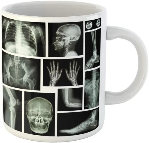 Taza de café Anatomía de rayos X Sistema esquelético humano de múltiples partes, 11 onzas, tazas de té de cerámica, recuerdo para familiares, Color 5