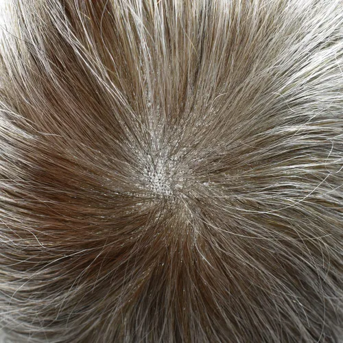 Miniatura 29 de Toupee para hombres nudos blanqueados hombres toupee hairpieces europeo virgen sistema de reemplazo de cabello humano suave encaje francés hombres