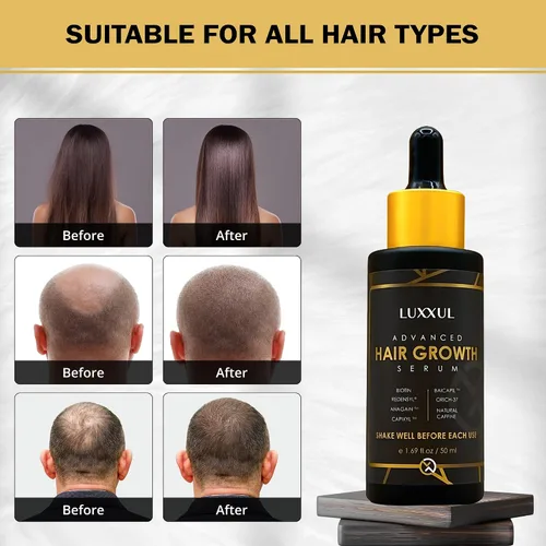 Miniatura 8 de LUXXUL Suero de apoyo para el crecimiento del cabello, 1.7 fl oz - Suero natural activo Redensyl para cabello más saludable, más grueso y lleno