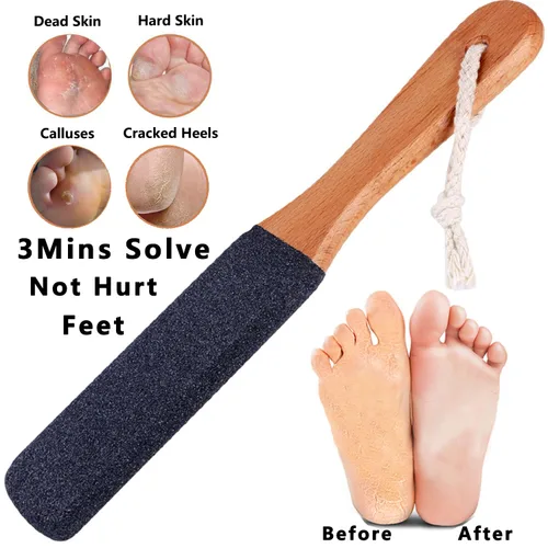 Miniatura 2 de LEKESI - Lima de piedra pómez para retirar callosidades y piel muerta de los pies, herramienta para exfoliar y masajear los pies, se usa con pies