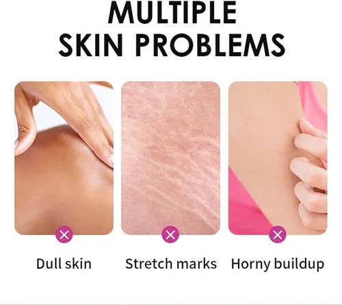 Miniatura 6 de Aceite de pelado amarillo, aceite de pelado fuerte para piel oscura, extra fuerte, solución exfoliante para el cuerpo, todo tipo de piel, removedor