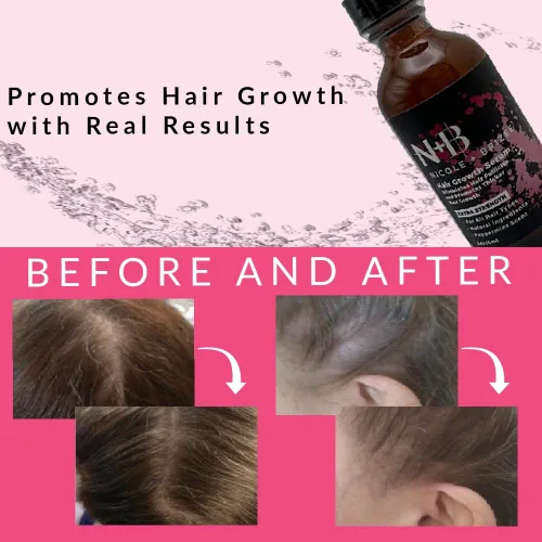 Miniatura 5 de N+B - Suero para el crecimiento del cabello, ayuda a promover un cabello más grueso, más lleno y saludable con biotina, fórmula de base natural