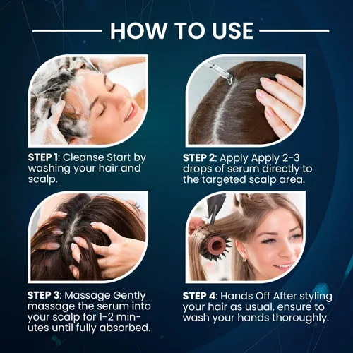 Miniatura 6 de 5 % de Minoxidil para el crecimiento del cabello para hombres y mujeres: Suero de crecimiento del cabello con biotina para la barba y la pérdida