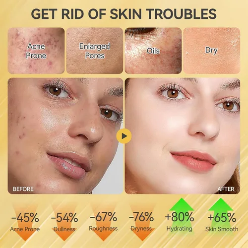 Miniatura 5 de Set de cuidado de la piel, juegos y kits revitalizantes para el cuidado de la piel de caracol facial, regalos para niñas adolescentes con limpiador