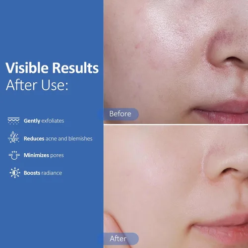 Miniatura 4 de Hicream Almohadillas de ácido glicólico, tónico exfoliante facial de doble textura para el cuidado de los poros y la luminosidad de la piel