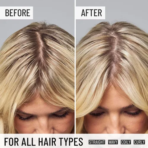 Miniatura 5 de Hairstory Prelavado – Enjuague micelar prebiótico para el cuero cabelludo para una limpieza profunda, elimina la acumulación y el aceite, equilibra