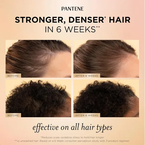Miniatura 4 de Alix Earle Pantene Abundant & Strong - Juego de regalo de 5 piezas, el régimen incluye champú (13.5 onzas), acondicionador (8 onzas), suero