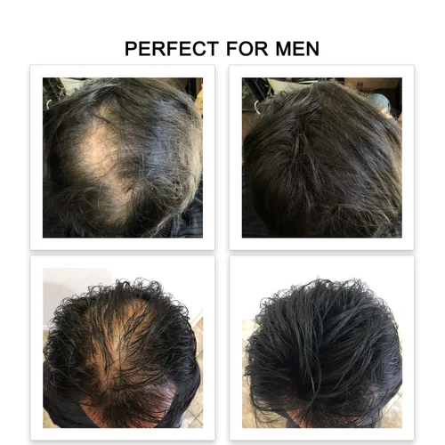 Miniatura 7 de FEBRON Fibras capilares para el cabello fino marrón oscuro para mujeres y hombres, corrector de pérdida de cabello, polvo para el cabello, base