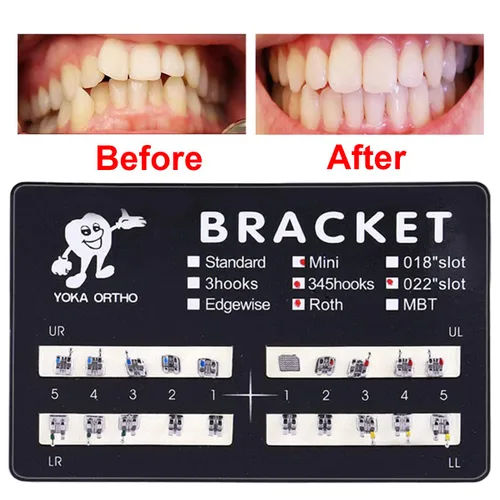 Miniatura 2 de VEZE Soportes dentales, 5 juegos de 100 piezas Mini Roth 022 ranura 345 ganchos, unido, compatible con MBT, unisex, uso en interiores, tema de salud