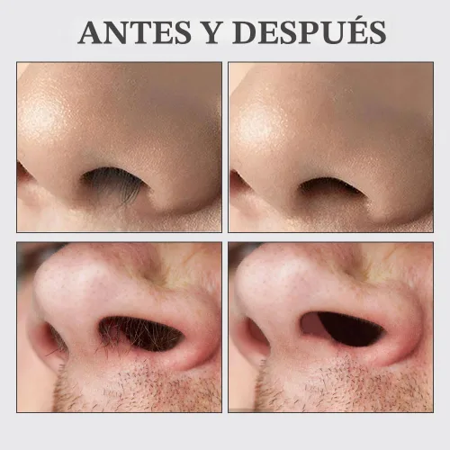 Miniatura 6 de Cortador de Vello Nasal Mejorado 2025, Herramienta Profesional 2 en 1 para Quitar Vello de Fosa Nasal, Cuchilla Afilada y Segura de Doble Cara