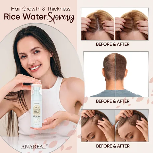 Miniatura 4 de Spray de aceite para el crecimiento del cabello: agua de arroz fermentada con biotina y aceite de ricino para engrosamiento diario del cabello