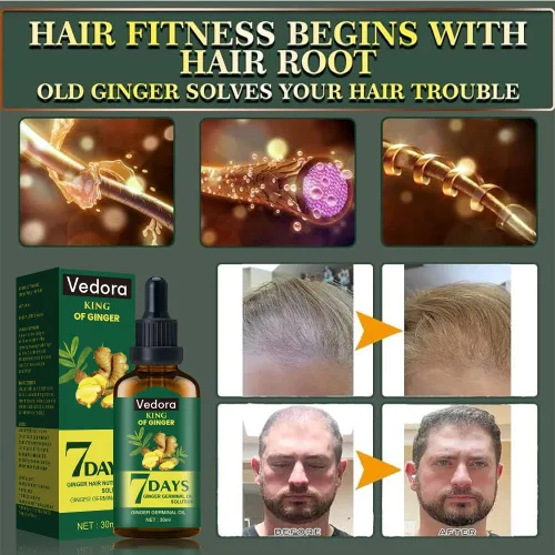 Miniatura 4 de Aceite de jengibre para el crecimiento del cabello, suero de biotina para el crecimiento del cabello, aceite esencial de jengibre natural 100% puro