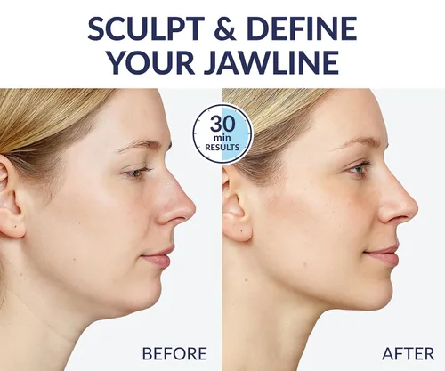 Miniatura 2 de STYLIA V Line - Máscara facial de colágeno de elevación – Levanta, reafirma y contornea la mandíbula – Correa de doble barbilla con ácido Azul