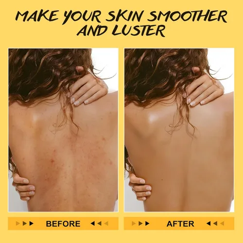 Miniatura 4 de POP MODERN.C Exfoliante corporal de cúrcuma y vitamina C para eliminar la piel muerta, mejora las manchas oscuras, acné, exfoliante orgánico natural