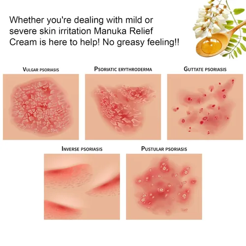 Miniatura 6 de Crema orgánica de loción de miel de manuka con avena coloidal, hidratante calmante para piel seca, para alivio, eccema de manos y cuerpo, psoriasis