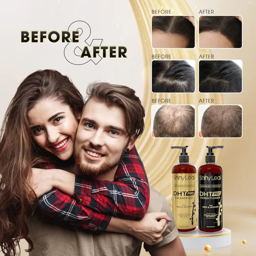 Miniatura 7 de DHT Pro Shampoo Fórmula avanzada con Procapil y Capixyl, bloqueadores de DHT y extractos naturales, champú antiadelgazamiento para hombres