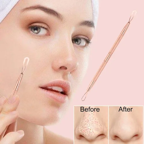 Miniatura 2 de 2 Herramienta profesional de acero inoxidable para eliminar puntos negros, herramienta extractor de manchas – acné, piel, nariz, cara, zona