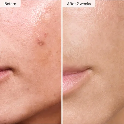 Miniatura 5 de Qure Skincare - Repuesto de filtro de ducha - Cartucho de repuesto para ducha, 99% de reducción de cloro, probado clínicamente, blanco, suministro