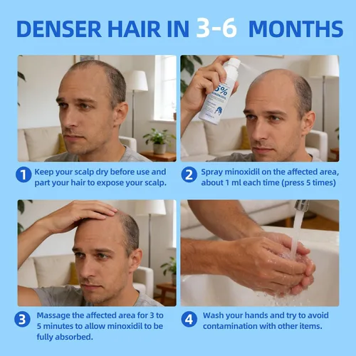 Miniatura 7 de Crecimiento del cabello de minoxidil al 5% para hombres y mujeres, fórmula mejorada, puede promover un suero de crecimiento del cabello más rápido