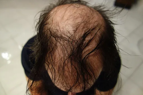 Miniatura 3 de Fibras de queratina para construir cabello Finally Hair, repuesto de 0.88 onzas, Café Oscuro Marrón oscuro con tono rojizo
