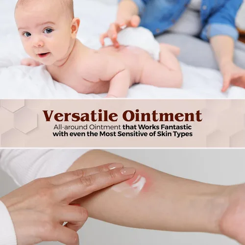 Miniatura 6 de MEDca Vitamina A y D Ungüento para erupción del pañal, crema protectora para piel sensible del bebé, fórmula de lanolina y vaselina, manos y pies
