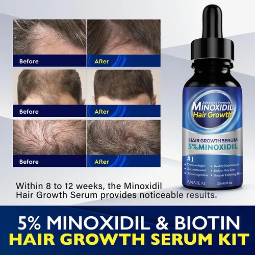 Miniatura 2 de ANAREAL Minoxidil para hombres y mujeres, 5% de mininoxidil para hombres para crecimiento de barba enriquecido con biotina, minoxidil