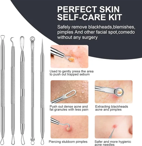 Miniatura 5 de Kit de eliminación de puntos negros, extractor de comedona de acné de acero inoxidable con lupa 10X y 20 almohadillas de alcohol al 75%, eliminación