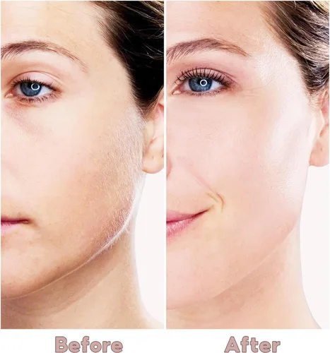 Miniatura 5 de Depilación facial para mujeres, recortadora facial sin dolor para labios superiores, pelusa de melocotón y barbilla con USB recargable Blanco