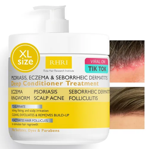 Acondicionador Antifúngico para Psoriasis, Eczema y Dermatitis Seborreica | Con Bloqueadores de DHT, Complejo Mineral y Aceite de Árbol de Té |