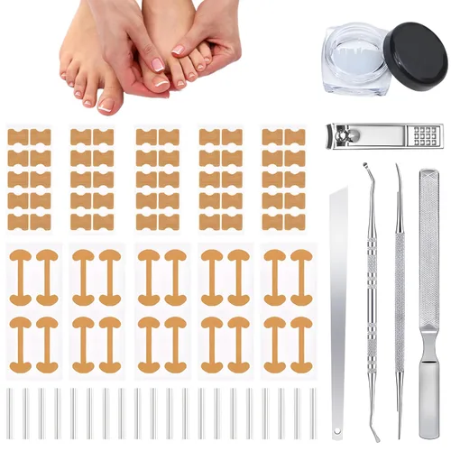 Kits de corrector de uñas encarnadas con tiras curvas, parches transpirables y herramientas de pedicura, juego de cuidado de uñas para una