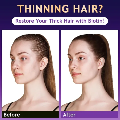 Miniatura 2 de Biotin - Champú para el crecimiento y engrosamiento del cabello con activador de raíces, champú para la pérdida de cabello para hombres y mujeres