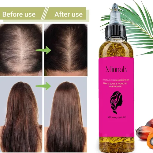 Miniatura 7 de Minnah - Aceite de batana para el crecimiento del cabello líquido 4 en 1, 1 unidad Crack Aceite de Crecimiento del Cabello Con Romero, Semilla De