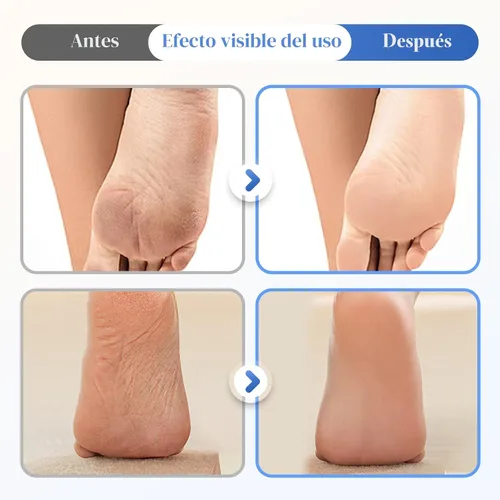 Miniatura 2 de Crema para Pies Hidratante y Anti-Grietas 60% Urea, 2025 Crema Hidratante Mejorada y Alivio para Grietas y Sequedad en Pies y Manos, Repara e
