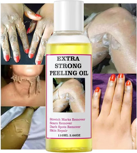 Miniatura 3 de Aceite de pelado amarillo, aceite de pelado fuerte para piel oscura, extra fuerte, solución exfoliante para el cuerpo, todo tipo de piel, removedor